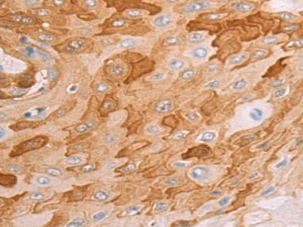 Rabbit Polyclonal Antibody to TTF2