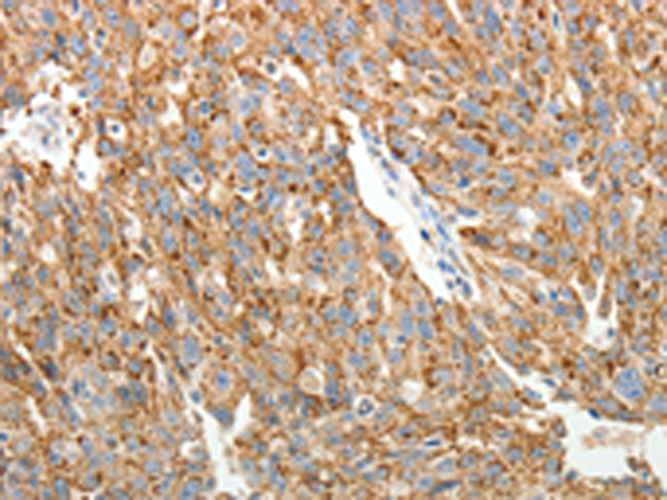 Rabbit Polyclonal Antibody to COL4A3