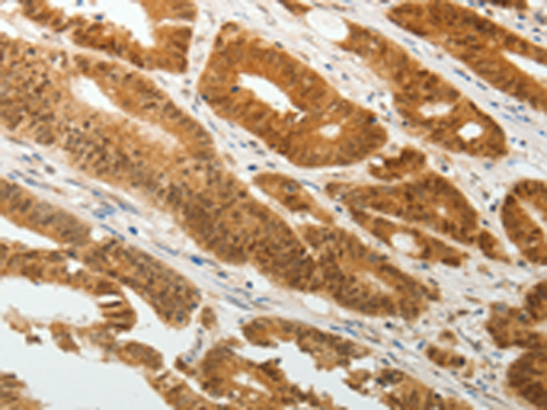 Rabbit Polyclonal Antibody to TWIST1