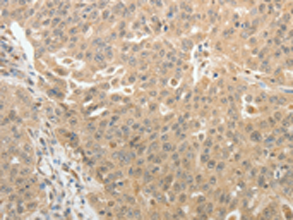 Rabbit Polyclonal Antibody to TH
