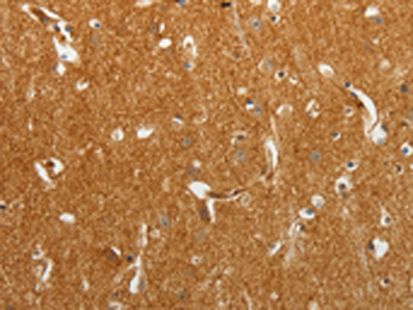 Rabbit Polyclonal Antibody to TMSB10