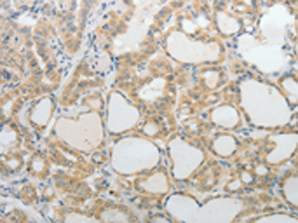 Rabbit Polyclonal Antibody to UCN