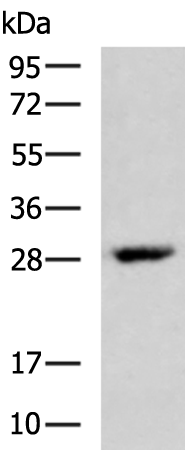 Rabbit Polyclonal Antibody to VEGFA