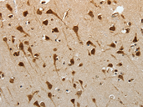 Rabbit Polyclonal Antibody to YBX1