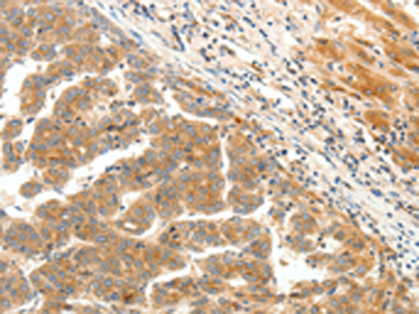 Rabbit Polyclonal Antibody to LPAR5