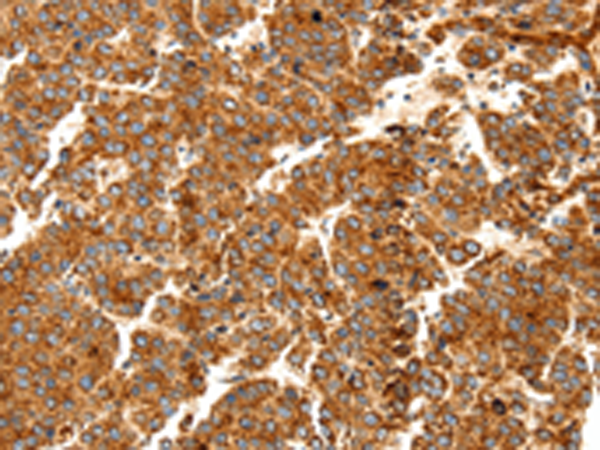 Rabbit Polyclonal Antibody to DOP1A