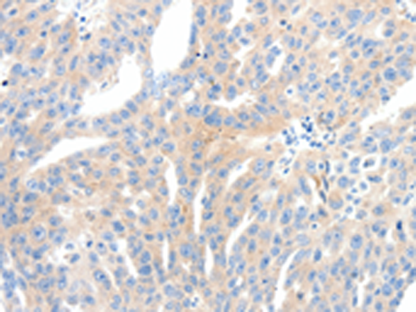 Rabbit Polyclonal Antibody to NFATC2