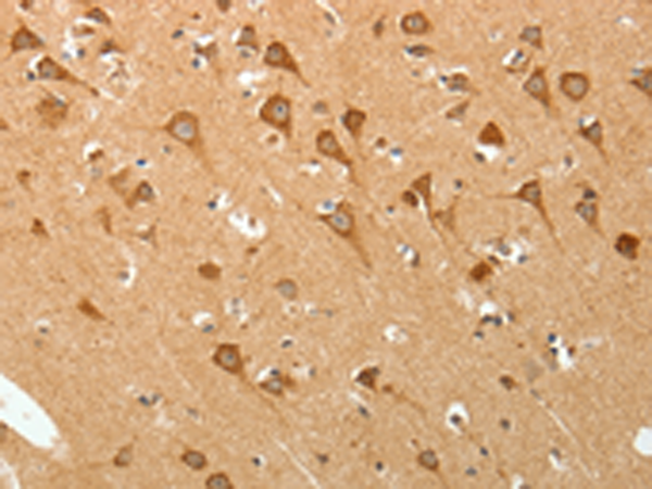 Rabbit Polyclonal Antibody to PGBD5