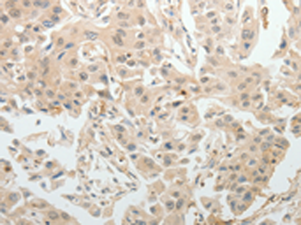 Rabbit Polyclonal Antibody to ABCB11