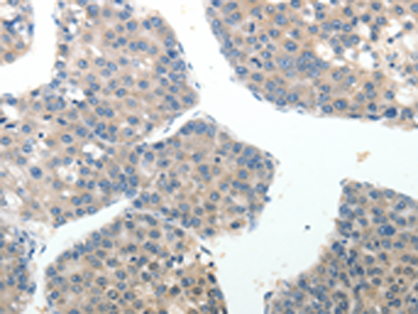 Rabbit Polyclonal Antibody to ABI3BP