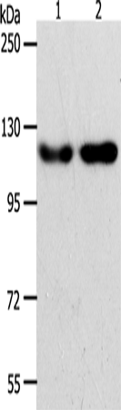 Rabbit Polyclonal Antibody to ABL2