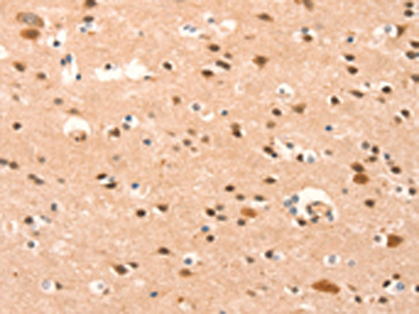 Rabbit Polyclonal Antibody to BAZ1A