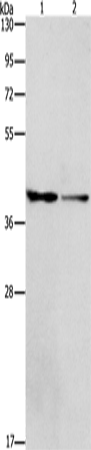 Rabbit Polyclonal Antibody to ACP2