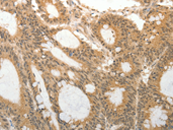 Rabbit Polyclonal Antibody to ADAR