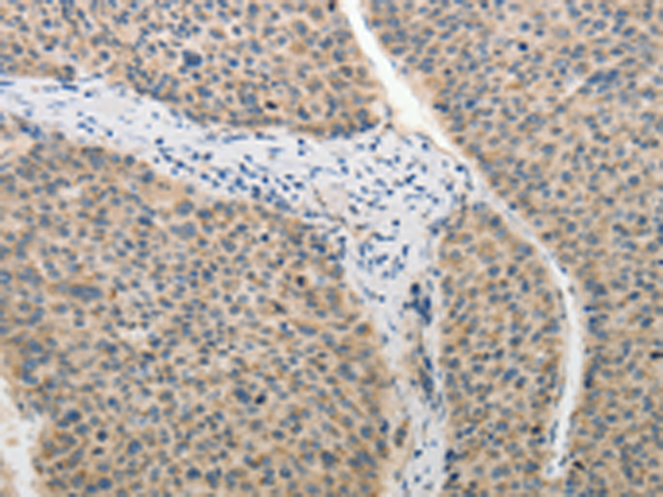Rabbit Polyclonal Antibody to ADHFE1
