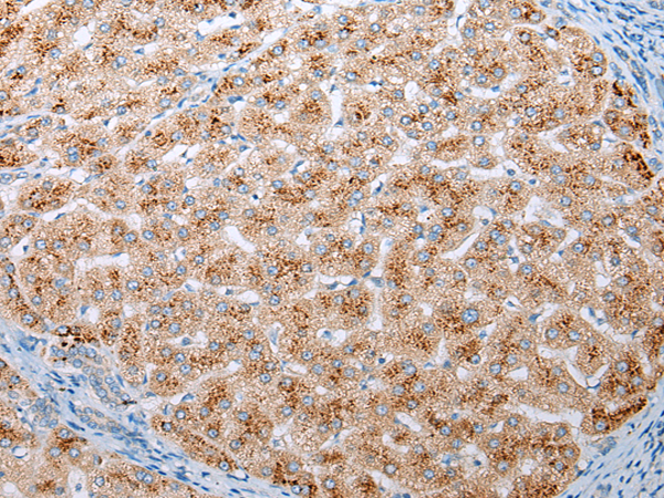 Rabbit Polyclonal Antibody to ADIPOR1