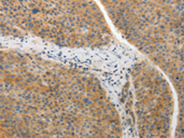 Rabbit Polyclonal Antibody to ADIPOR2
