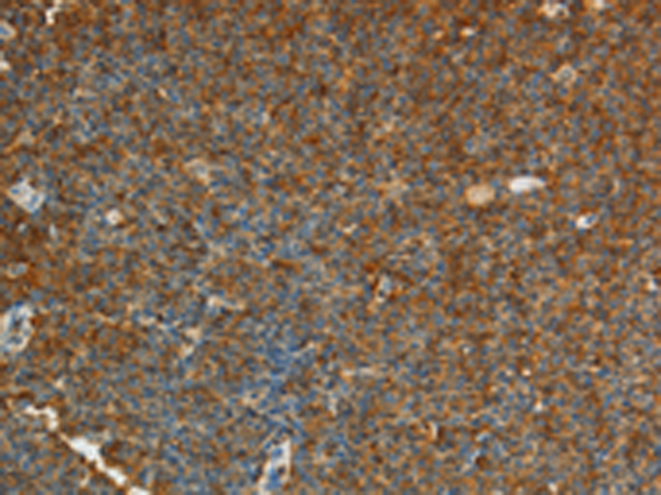 Rabbit Polyclonal Antibody to ADM