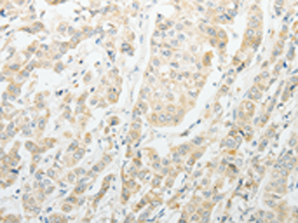 Rabbit Polyclonal Antibody to AGBL1