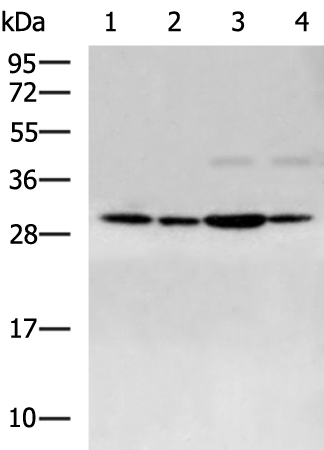 Rabbit Polyclonal Antibody to AGPAT2