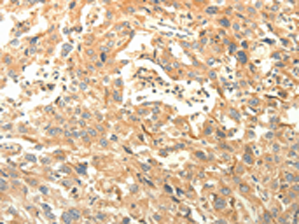 Rabbit Polyclonal Antibody to AGRN