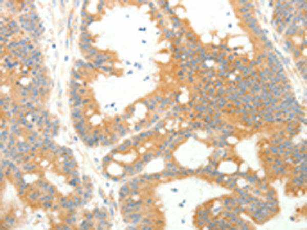 Rabbit Polyclonal Antibody to AGRP