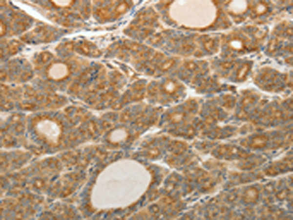 Rabbit Polyclonal Antibody to AKR1C1