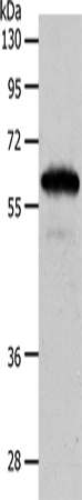 Rabbit Polyclonal Antibody to INA