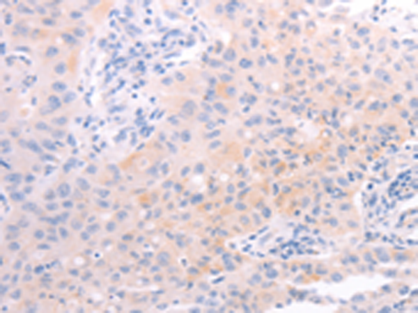 Rabbit Polyclonal Antibody to AMH