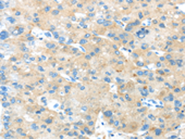 Rabbit Polyclonal Antibody to ANGPTL5