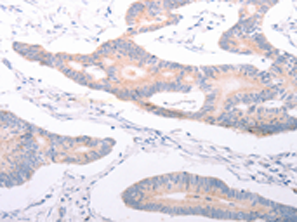 Rabbit Polyclonal Antibody to ANKRA2