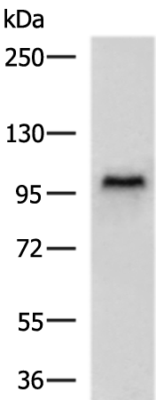 Rabbit Polyclonal Antibody to ANKRD28