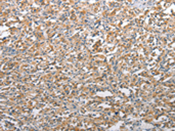 Rabbit Polyclonal Antibody to TSC2