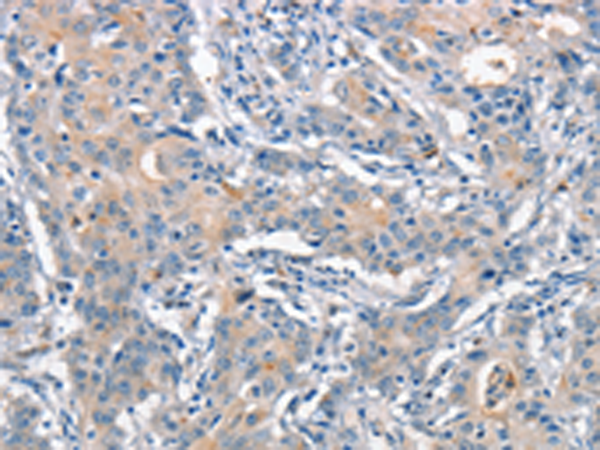 Rabbit Polyclonal Antibody to ANAPC1