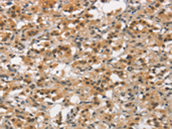 Rabbit Polyclonal Antibody to ANAPC4