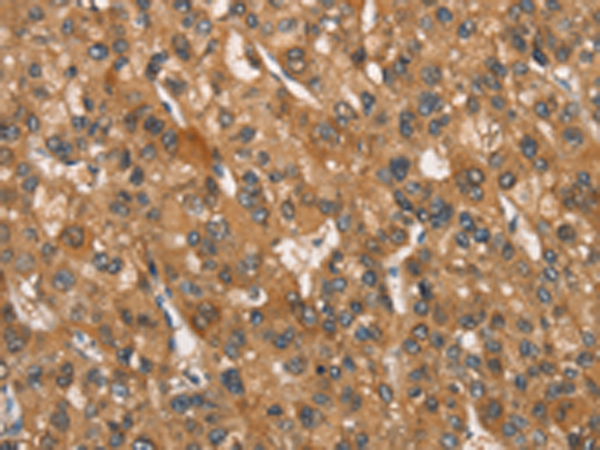 Rabbit Polyclonal Antibody to NAXE