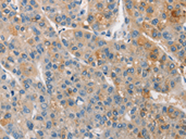 Rabbit Polyclonal Antibody to APOA5