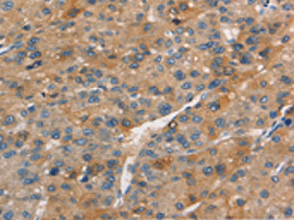 Rabbit Polyclonal Antibody to APOC4