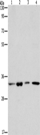 Rabbit Polyclonal Antibody to ARPC2