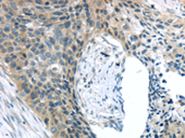 Rabbit Polyclonal Antibody to KIT