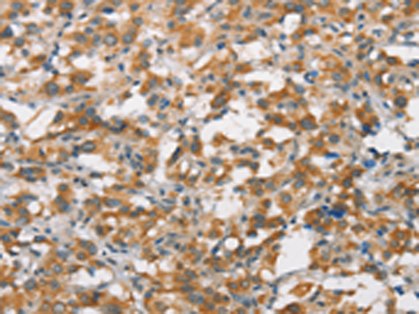 Rabbit Polyclonal Antibody to FZD1