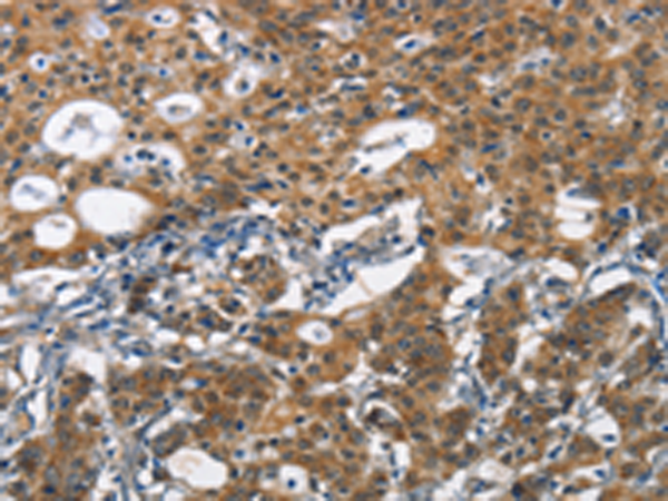 Rabbit Polyclonal Antibody to DCC