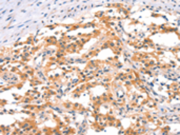 Rabbit Polyclonal Antibody to IKBKB