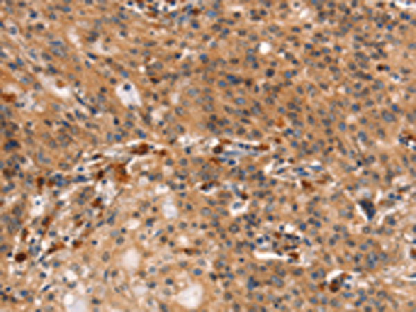 Rabbit Polyclonal Antibody to DCLK1