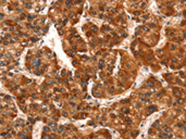 Rabbit Polyclonal Antibody to GJA8