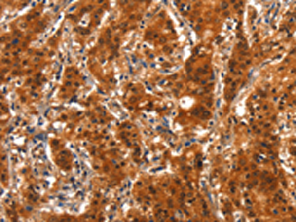 Rabbit Polyclonal Antibody to SMURF2