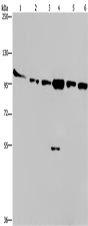 Rabbit Polyclonal Antibody to PRKD3