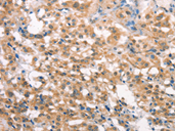 Rabbit Polyclonal Antibody to LATS2