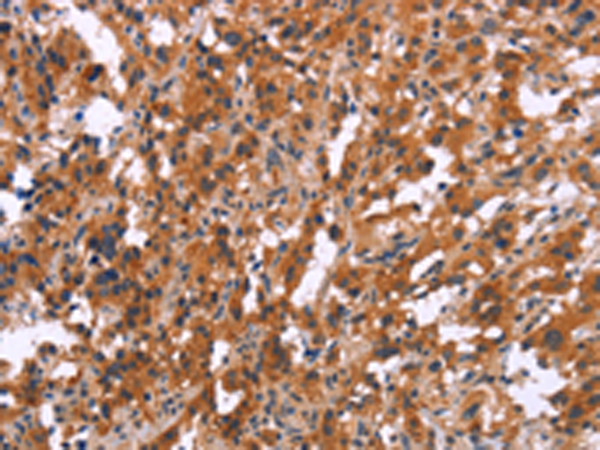 Rabbit Polyclonal Antibody to MAPK11
