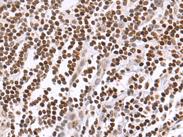 Rabbit Polyclonal Antibody to MAPK13